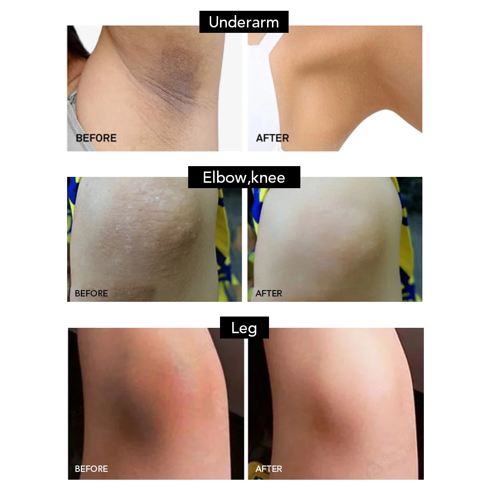 Savon Noir Africain illumine la peau, réduit l’acné, nettoie et hydrate