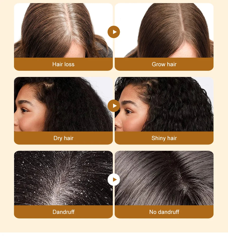 Huile Croissance Cheveux – Réduit la chute, renforce les cheveux.