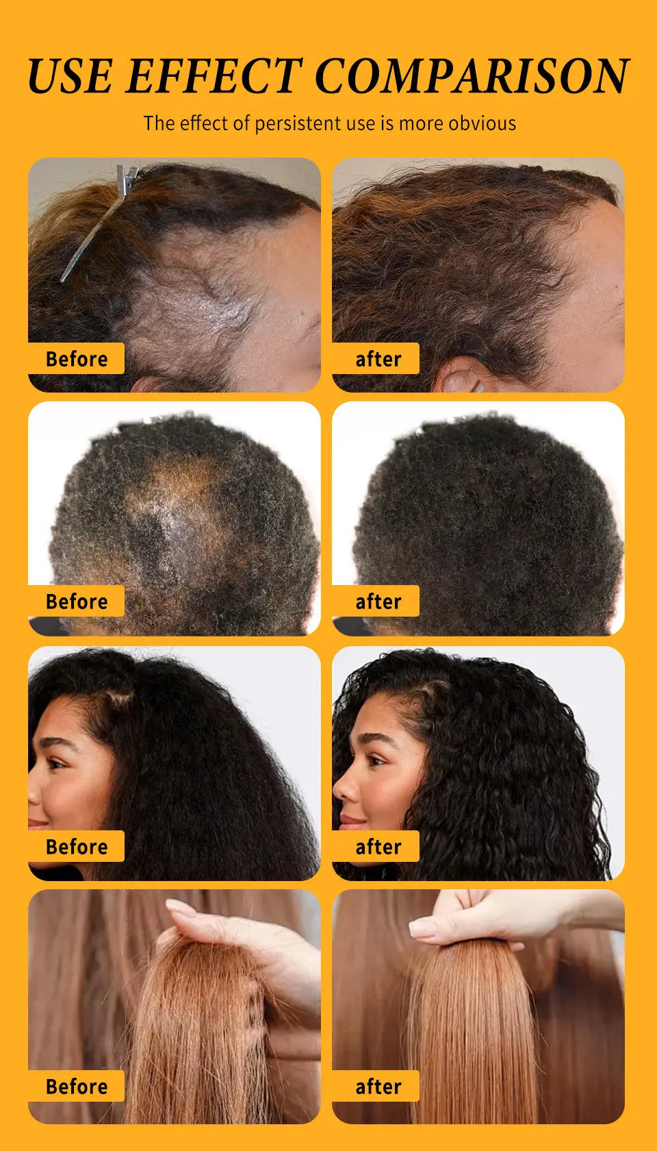 Huile Croissance Cheveux – Réduit la chute, renforce les cheveux.
