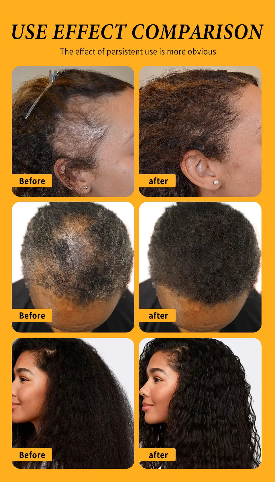 Huile Croissance Cheveux – Réduit la chute, renforce les cheveux.