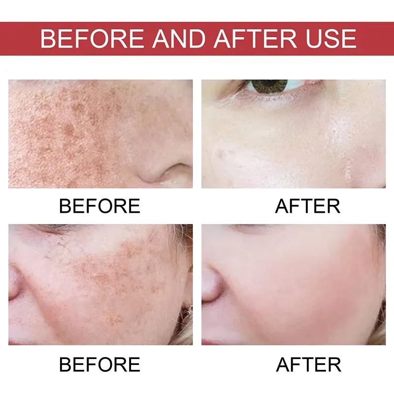 Sérum Liftant aux Peptides de Soie