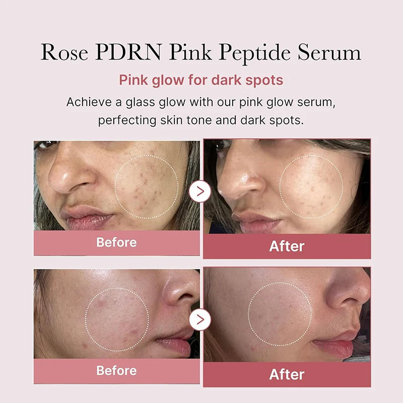 Sérum Liftant aux Peptides de Soie